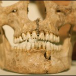 teeth1.jpg
