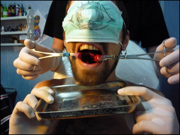 lower-inner-eye-tongue-splitting-3