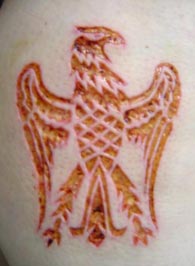 healing skin removal scarification