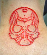 Skin removal scarification by Ryan Ouellette