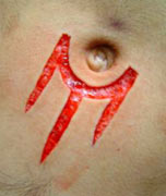 Skin removal scarification by Ryan Ouellette