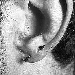 ear arrow