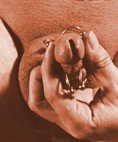 Foreskin Rings