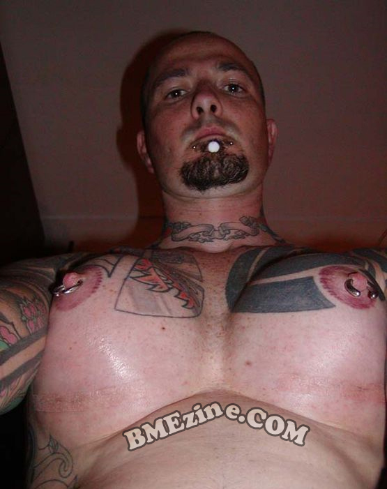 male breast implants 3