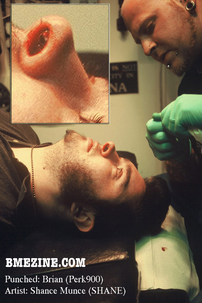 septum4 septum4