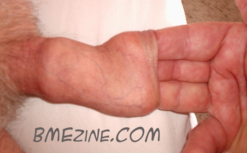 stretchfinger