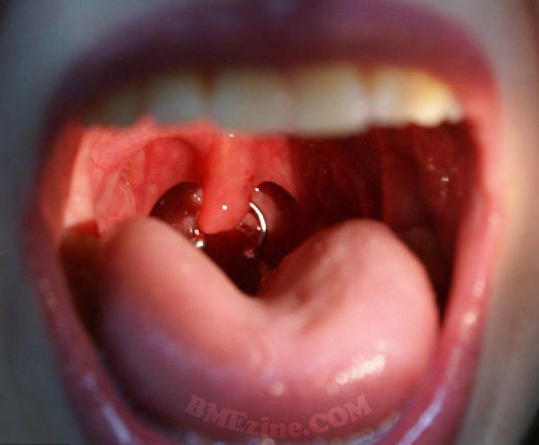 uvula