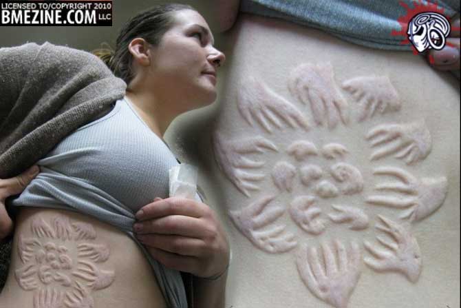 Healed - 2 years later