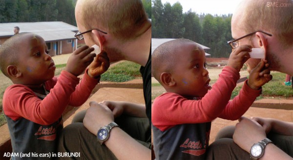 adam-burundi-ear