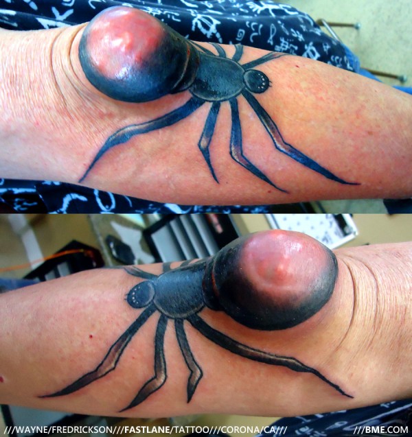 goutspider