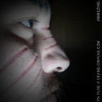 iestyn-scar-2