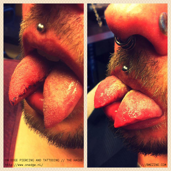 quicktongue