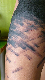 skintraces2t