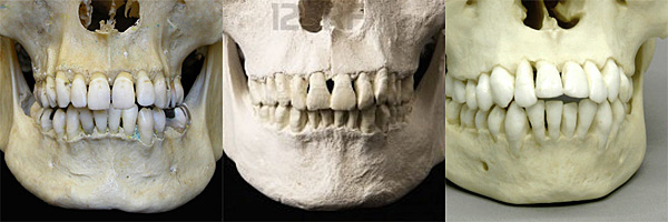 teeth
