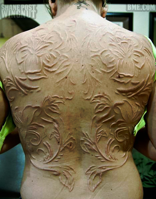 backscar