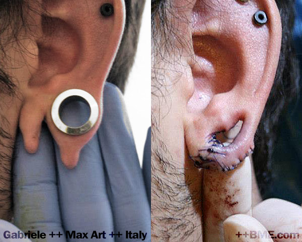 gabriele-ear-repair