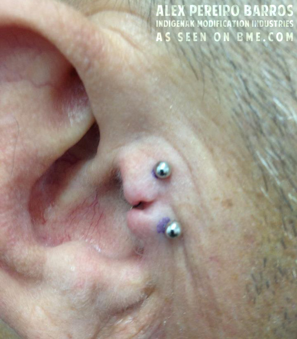 double-tragus
