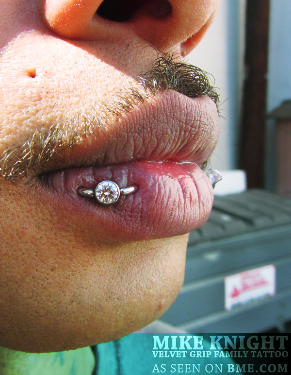 lip-orbital