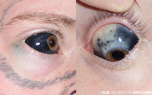 Elio's Eyeball Tattoo