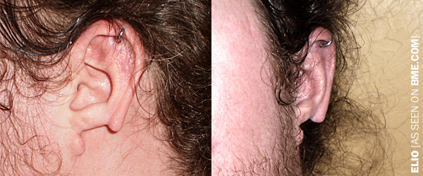 Elio's Left Ear