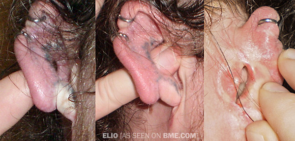 Elio's Right Ear