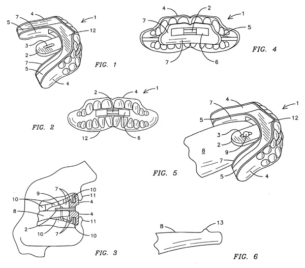 sillypatent-US20070163603