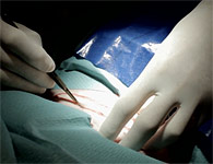 skinring-2t