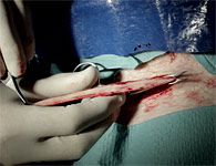 skinring-5t