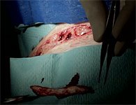 skinring-6t