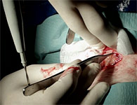 skinring-7t