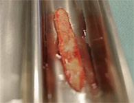 skinring-8t