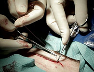 skinring-9t