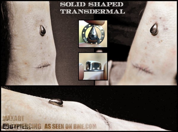 solidshapedtransdermal-2