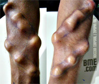 adiccion-corporal-forearm-ridges-3t