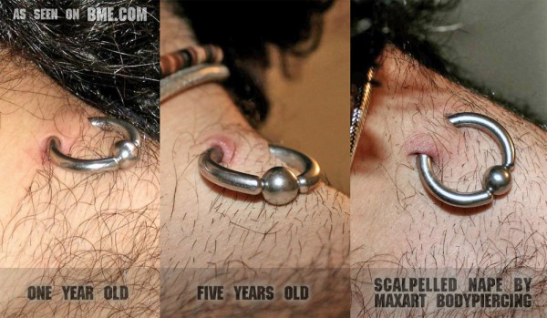 ancient-nape