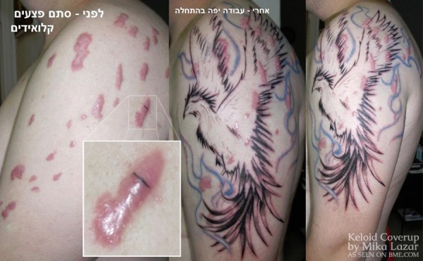 dan-keloid-phoenix-1