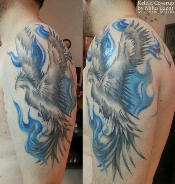 dan-keloid-phoenix-3