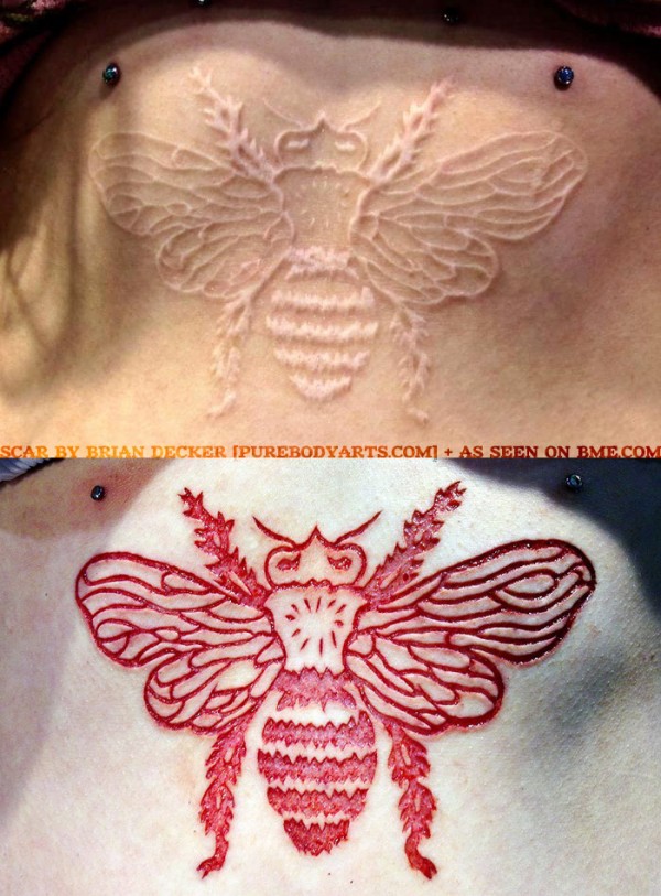 healed-scar-by-brian