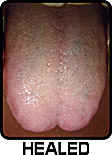 tongue-tattoo-4t