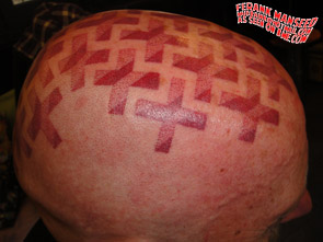 scalp-tattoo-3t